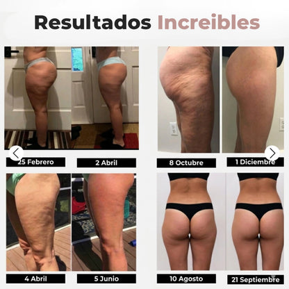 2X1 LEGGINGS ANTICELULITIS DE COMPRESIÓN 3D