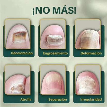 Uñas Libres en 7 Días