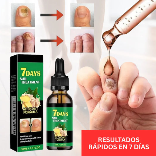 Uñas Libres en 7 Días