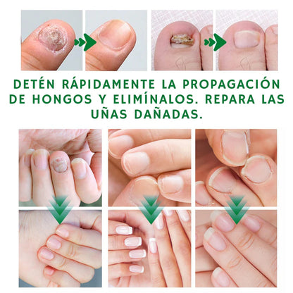Uñas Libres en 7 Días