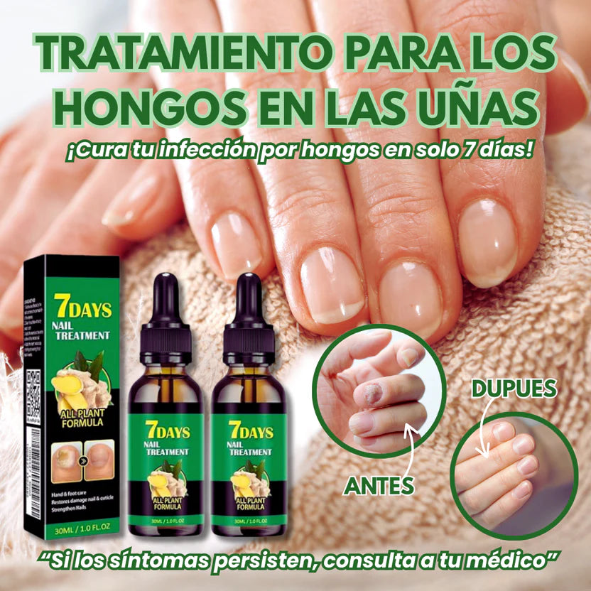Uñas Libres en 7 Días