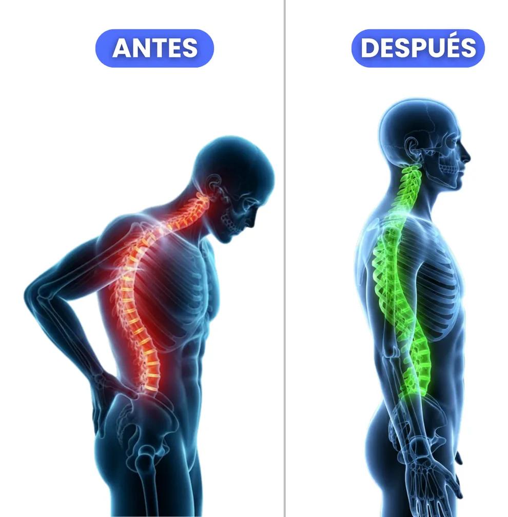 Corrector Postura