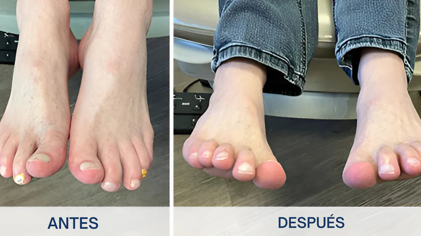 Uñas Libres en 7 Días